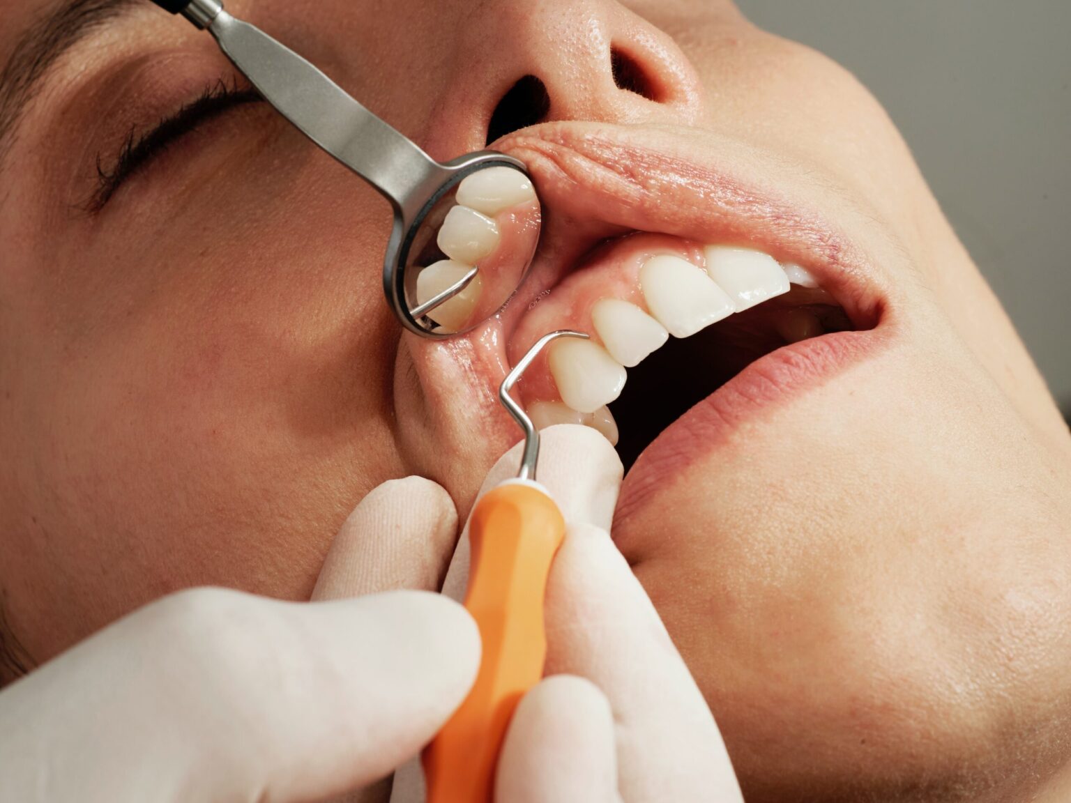 A close-up of a dental examination in an affordable Dallas dentist clinic showing tools inspecting teeth.
