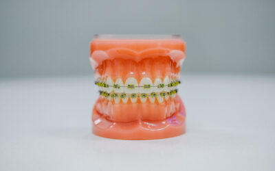 Texas Dentistry Breaks Down How Orthodontic Treatment Works