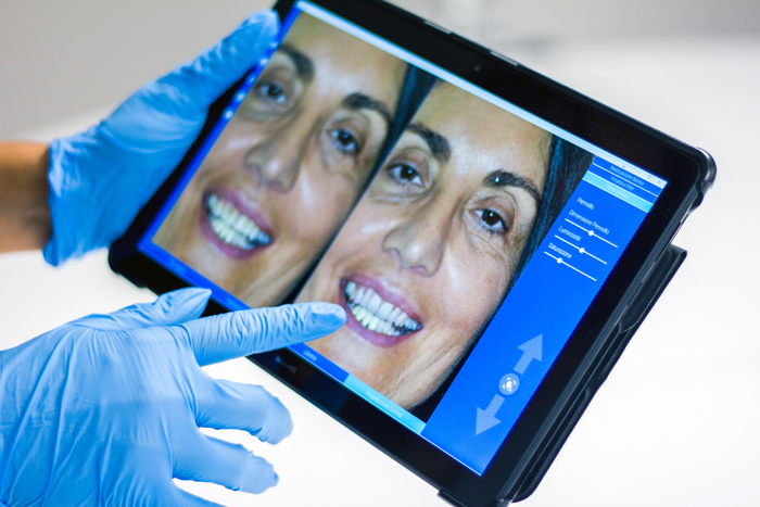 A professional at a Dallas dentist office comparing before and after dental treatment photos on a tablet.