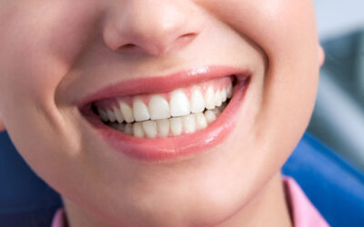 Gum Contouring: What It Is and Why You Might Need It