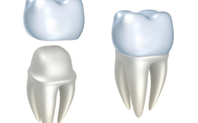 Save Your Smile and Boost Your Health with Dental Crowns