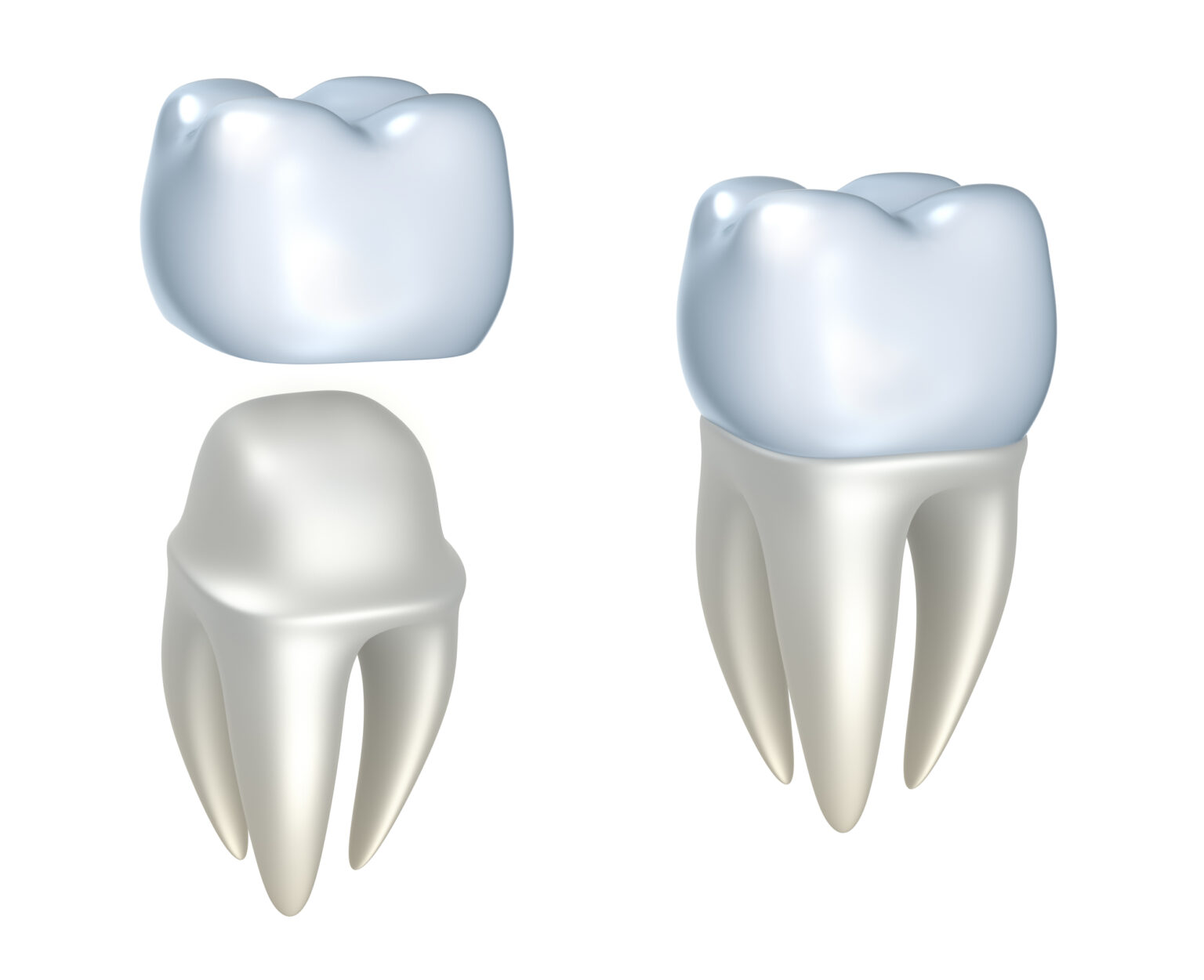 Digital illustration suitable for a dental clinic, showcasing human molars with a single crown and a full tooth including roots.