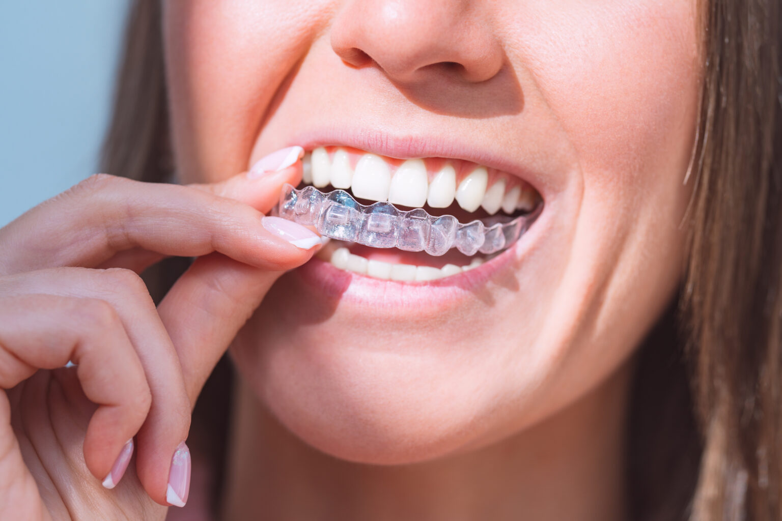 Woman inserting a clear orthodontic aligner onto her teeth at a dental office.