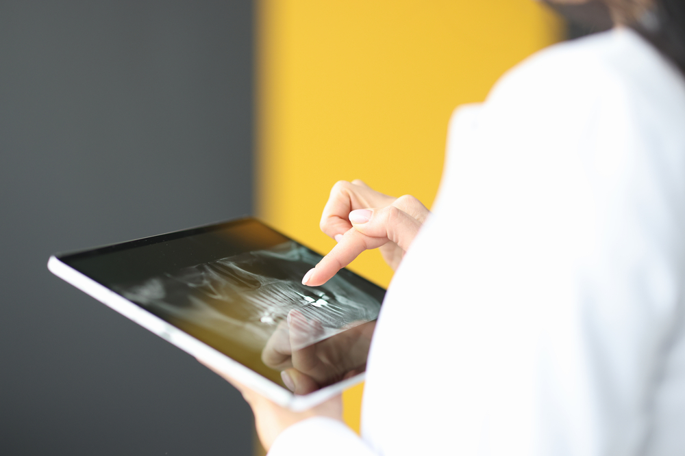 Healthcare professional reviewing a digital x-ray image on a tablet at an affordable Dallas dentist office.