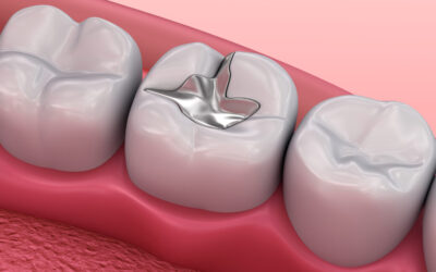 Check it out! Dental Fillings Types, Benefits, and Maintenance