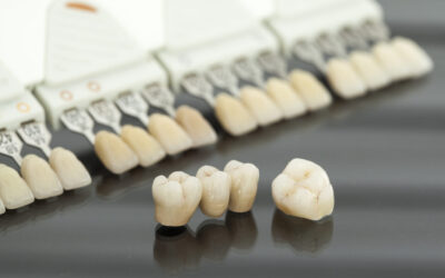 What’s best for your smile?: Dental Crowns, Fillings, or Veneers