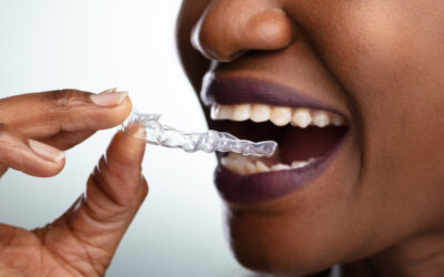 The Best Clear Aligner Brand: Comparing Invisalign®, Byte®, Alignerco, and More