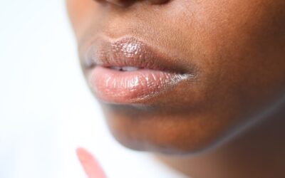 Dentist in Dallas, TX, Reveals 5 Reasons to Wear UV Protection on Your Lips
