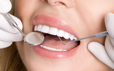 Dallas Veneers vs. Other Cosmetic Services: What Makes Them the #1 Choice in DFW?