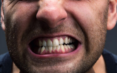 Ask a Dentist in Dallas, TX: How Do I Know If I’m Grinding My Teeth?