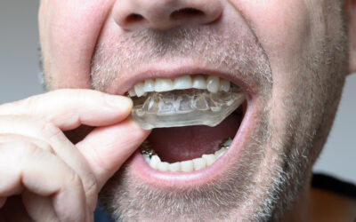 Waking Up With Jaw Pain? A Custom Night Guard May Protect More Than Your Teeth